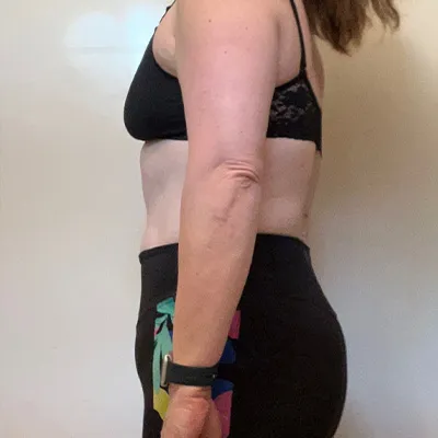 Before-and-after images of clients' fitness transformations with Prolific Health coaching.