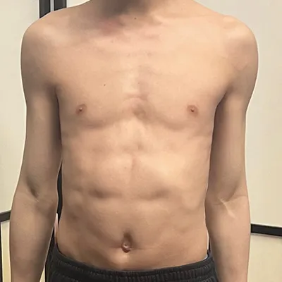 before, kelvin l before