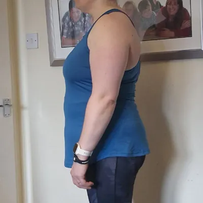 before, linnea r before