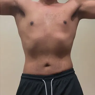 before, manny g after