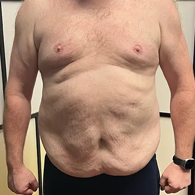 Before-and-after image of a client’s transformation showcasing weight loss and improved health with Prolific Health coaching.
